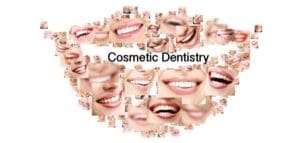 Cosmetic Dentistry