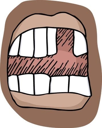 The best smiles are those that have all their teeth