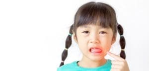 Children's Chipped Teeth