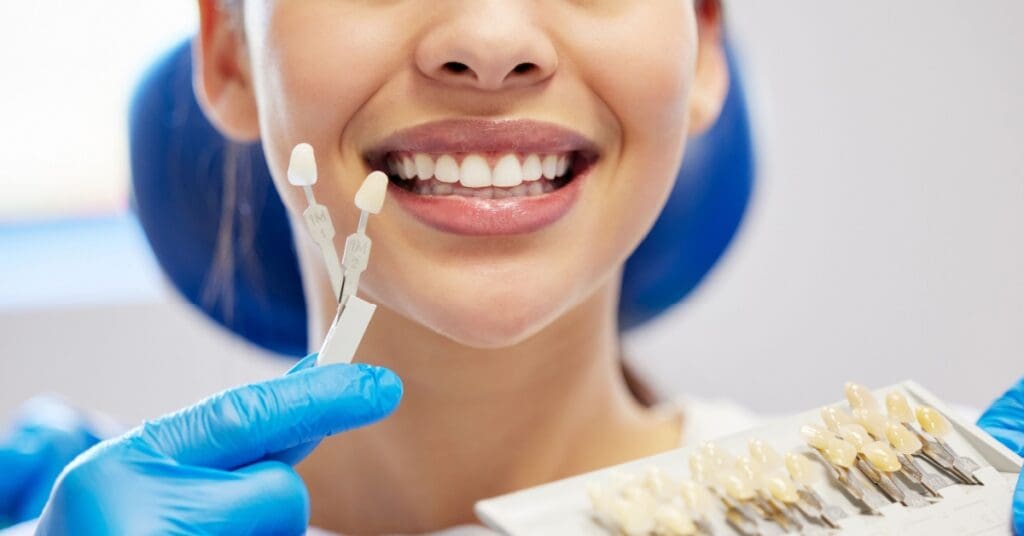 dental veneers, concept of What Dental Veneers Could Do for Your Smile - and Your Self-Confidence