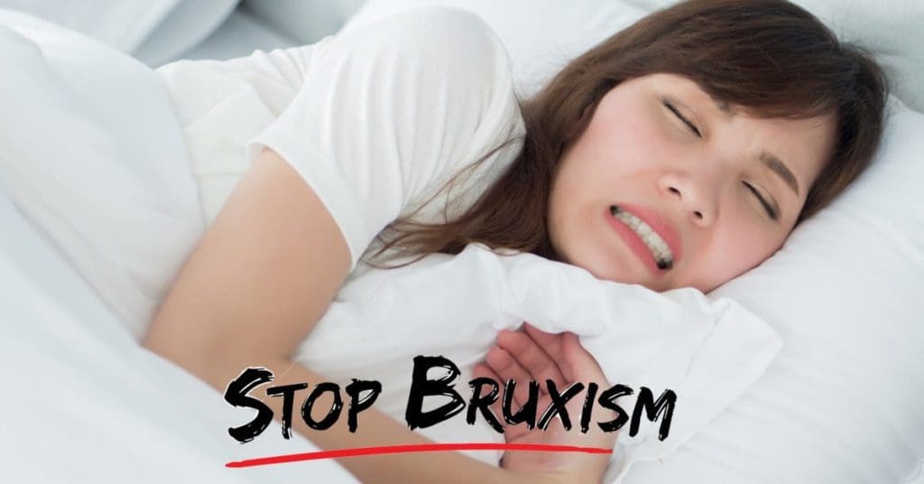 Bruxism & Benefits of a Night Guard to Prevent Teeth Grinding