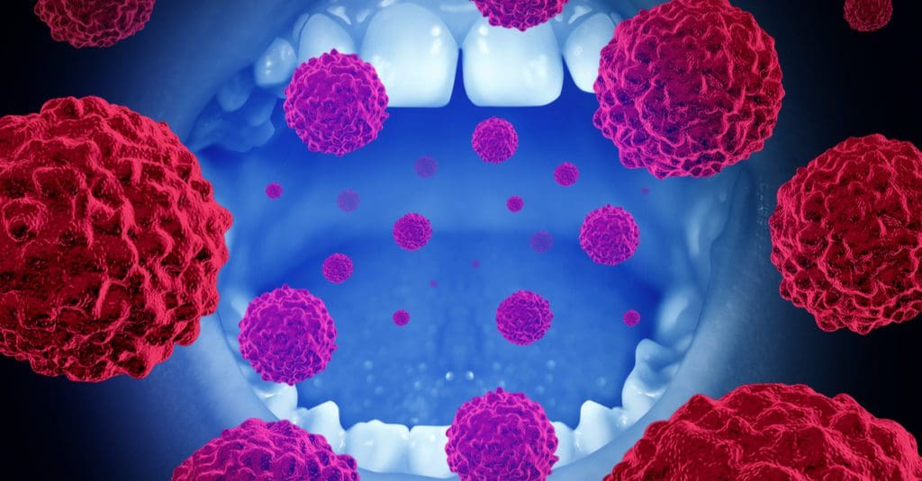 Warning Signs of Oral Cancer?