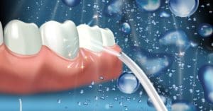 How to Fix Common Water Flosser Issues