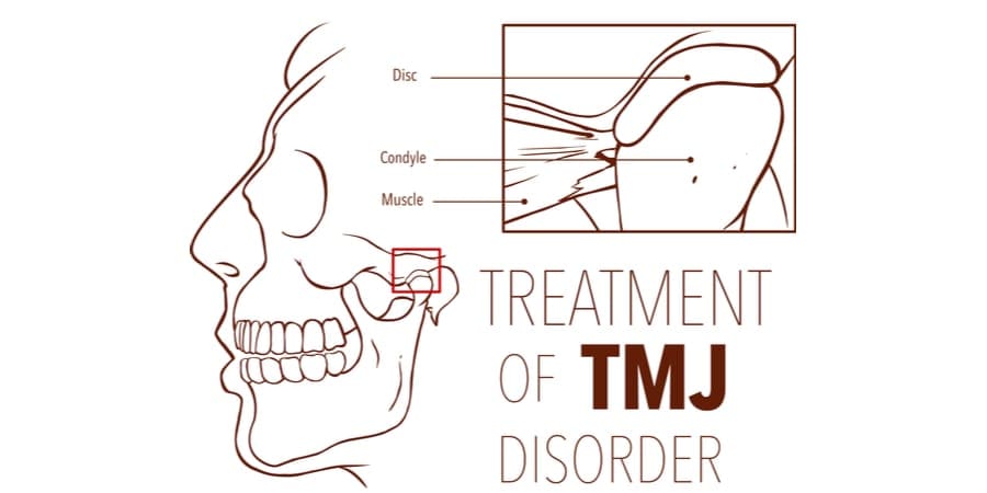 TMJ Therapy Temporomandibular Joint Syndrome