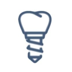 periodonditis dental implant