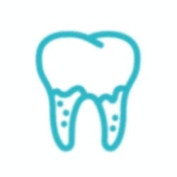 Periodontitis Pocket reduction
