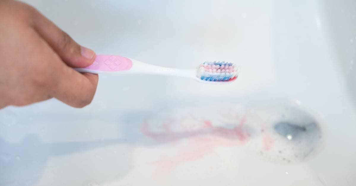 Spongy And Bleeding Gums Are Symptoms Of Which Disease And Deficiency