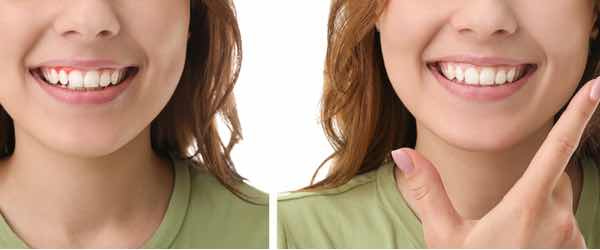 periodontal treatments