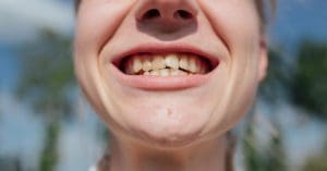 I Hate My Teeth! What Can I Do?