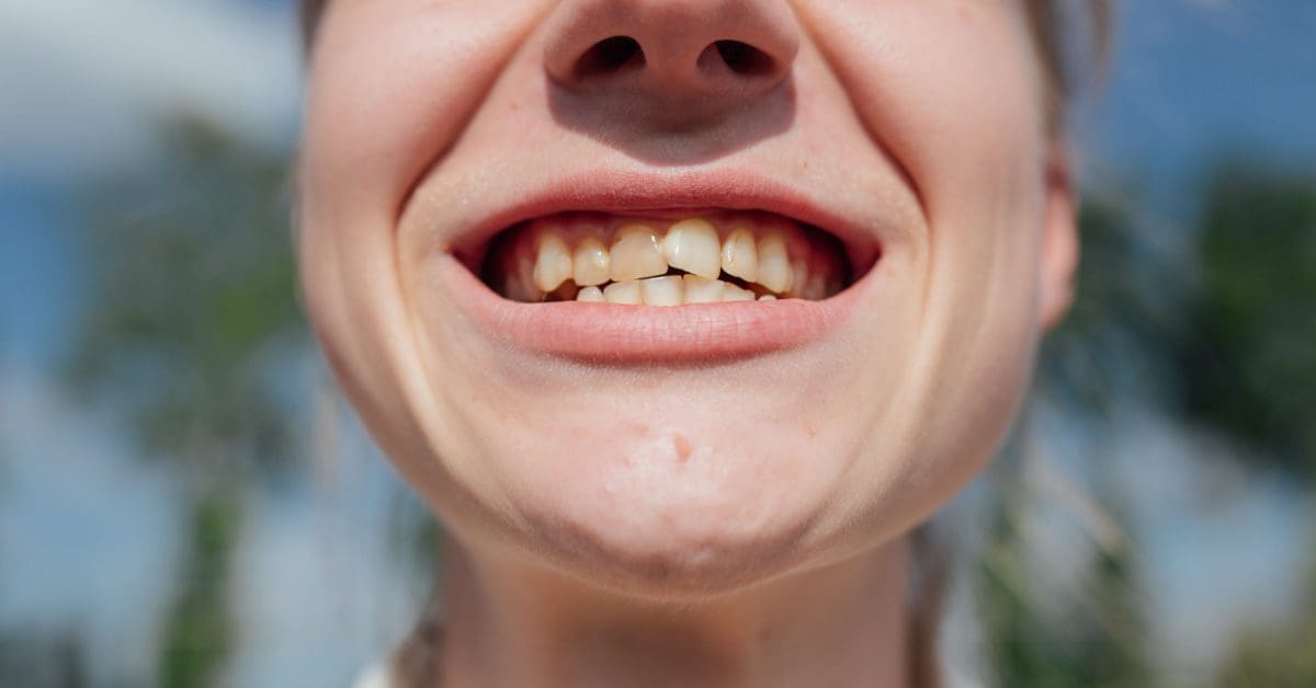I Hate My Teeth! What Can I Do?